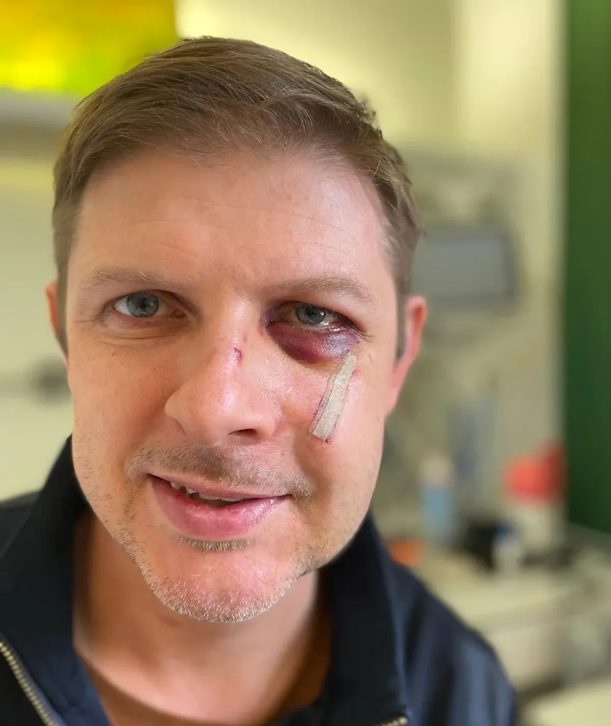 Matthias Ecke, otro político alemán hospitalizado. Matthias Ecke, otro político alemán hospitalizado.