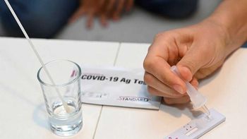 Los usuarios adquieren el compromiso de informar elresultado de la prueba al adquirir el autotest. Los usuarios adquieren el compromiso de informar elresultado de la prueba al adquirir el autotest.