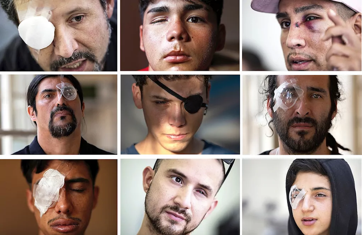 En el 2019, los balines disparados por las fuerzas de seguridad contra manifestantes universitarios dejaron sin vista a 272 personas en un mes. En el 2019, los balines disparados por las fuerzas de seguridad contra manifestantes universitarios dejaron sin vista a 272 personas en un mes.