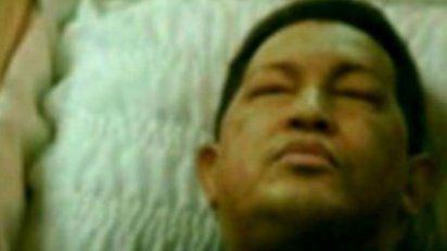 Difunden foto de Chávez muerto