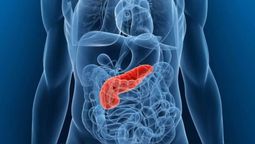 Cáncer de páncreas: Evite esta bebida antes de que sea peor.
