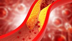 La bebida para bajar el colesterol que recomienda una nutricionista.