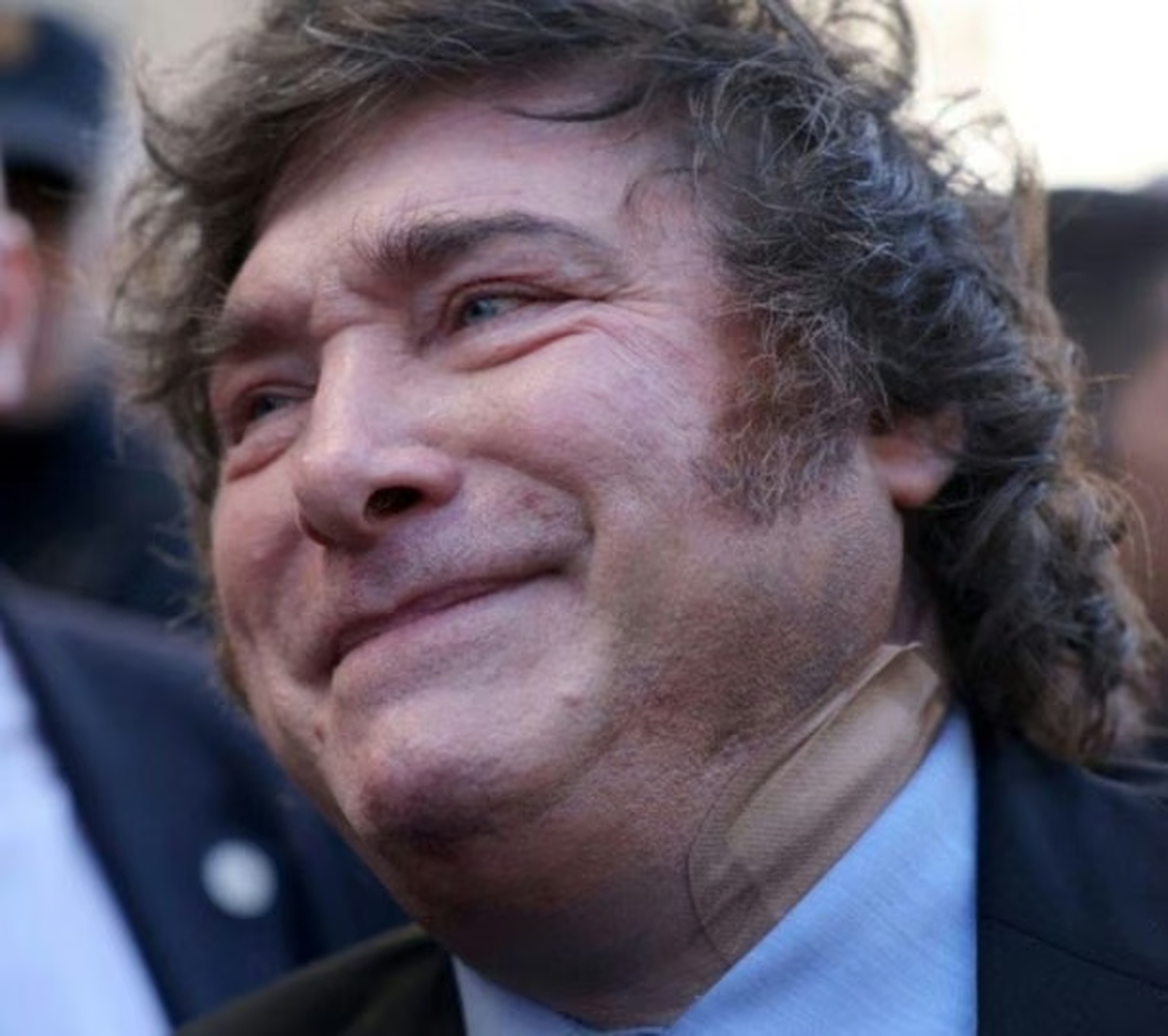 Javier Milei y su "accidente dom&eacute;stico"