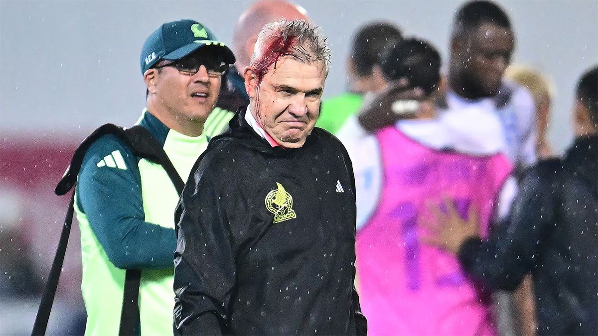 Honduras fue castigada por la Concacaf con la disputa de un partido sin público tras la agresión que sufrió el entrenador de México, Javier Aguirre. Honduras fue castigada por la Concacaf con la disputa de un partido sin público tras la agresión que sufrió el entrenador de México, Javier Aguirre.
