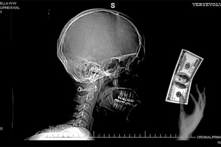 Neurofinanzas: las claves.