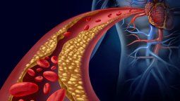 Fruta para bajar los molestos niveles de colesterol alto. Fruta para bajar los molestos niveles de colesterol alto.