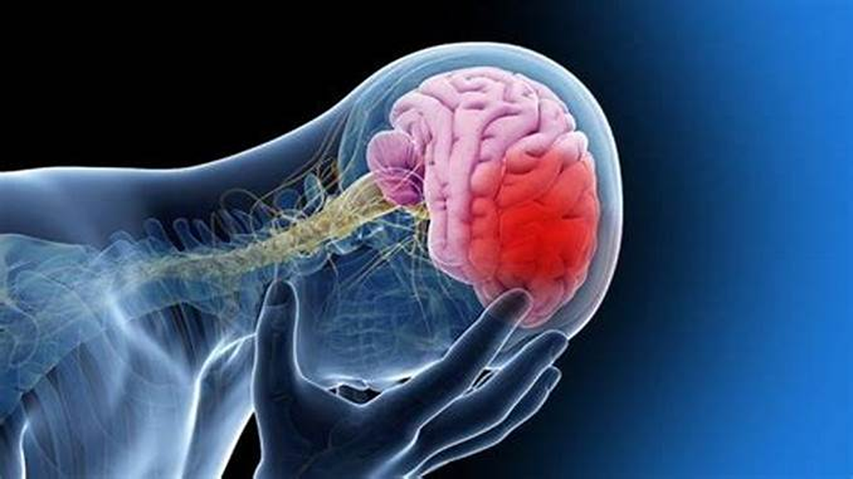 Según los Institutos Nacionales de Salud de los Estados Unidos "Los ataques isquémicos transitorios suelen ser una señal de advertencia de futuros derrames" Según los Institutos Nacionales de Salud de los Estados Unidos "Los ataques isquémicos transitorios suelen ser una señal de advertencia de futuros derrames"