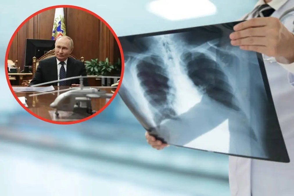 Fotomontaje con Vladimir Putin y una imagen alusiva a la peste neumónica.