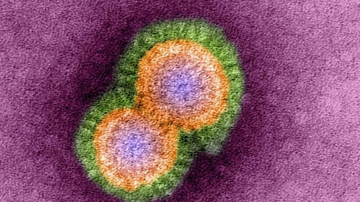 La gripe aviar H5N1 es un "campeón en mutar". La gripe aviar H5N1 es un "campeón en mutar".