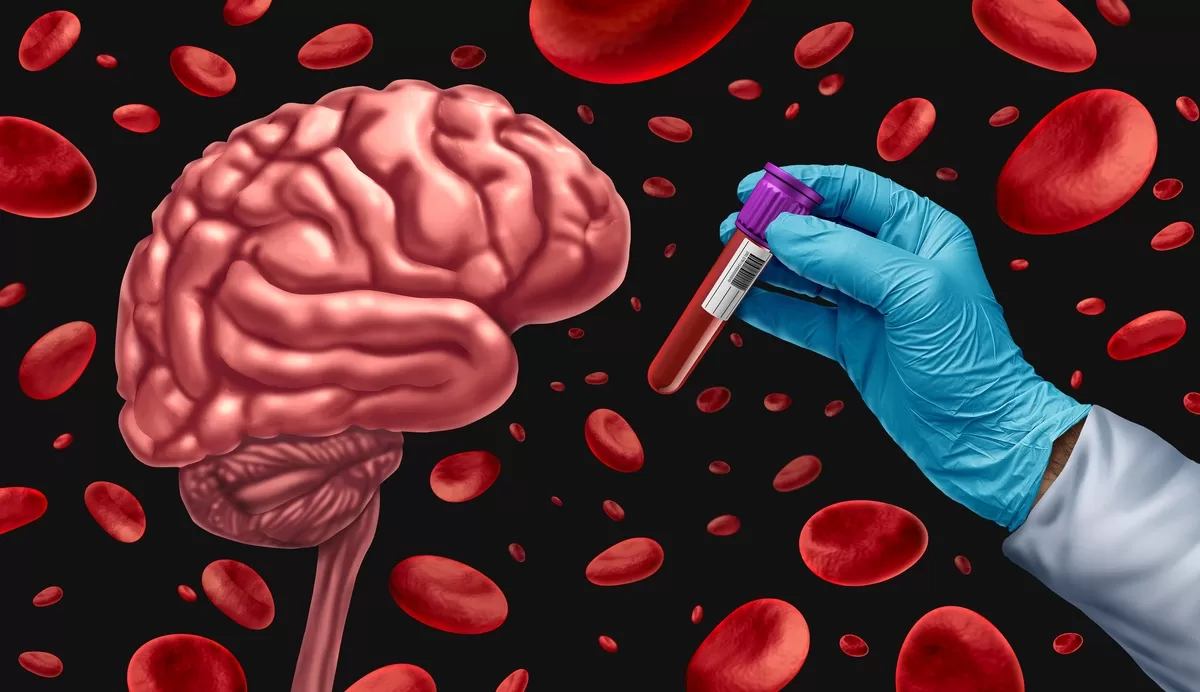 Con nuevas pruebas de sangre para Alzheimer aprobada por la FDA, la prognosis de la enfermedad asume un giro de 180°.