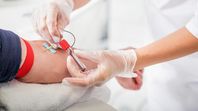 Los laboratorios de análisis de sangre y orina el adulto mayor debe hacerlos con frecuencia anual si su estado de salud es normal y más frecuentes para el seguimiento de patologías. Los laboratorios de análisis de sangre y orina el adulto mayor debe hacerlos con frecuencia anual si su estado de salud es normal y más frecuentes para el seguimiento de patologías.