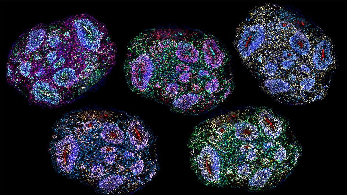 Ungrupo de científicos realizó un experimento en el que llevan en estado demaduración unos minicerebros humanos cultivados en laboratorio.