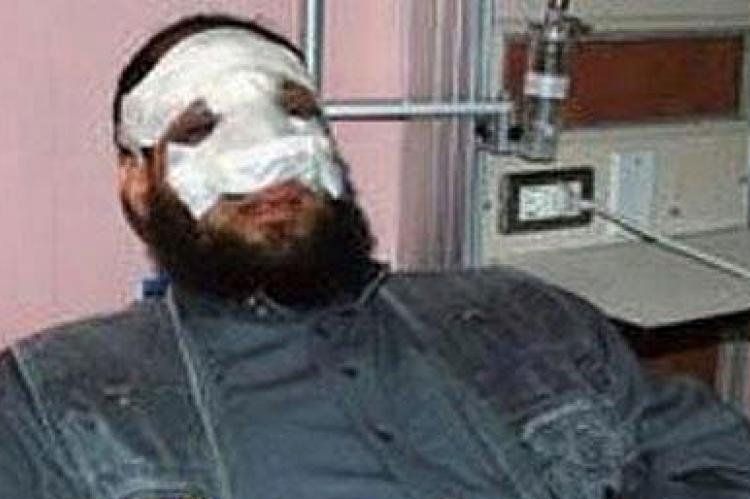 Anuar el Balkimy, ex diputado de Egipto, ocultando su cirugía estética.