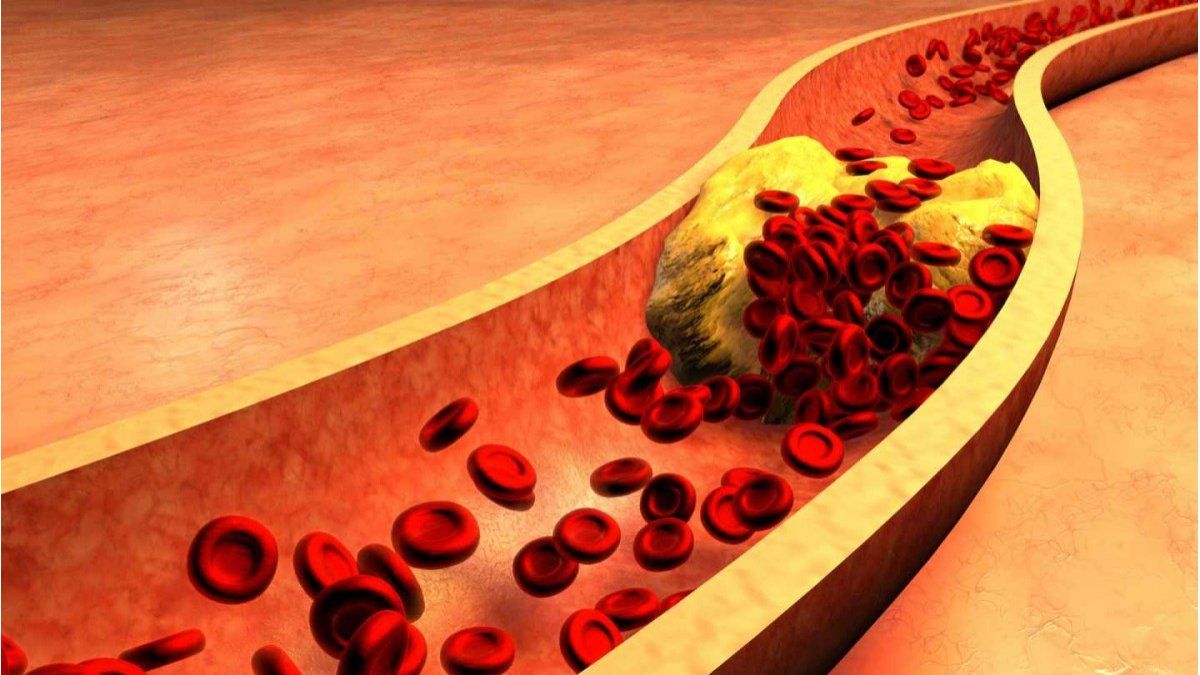 These are the most dangerous foods for your cholesterol