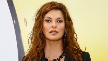 Salud estética: ¿Qué le pasó a Linda Evangelista? Salud estética: ¿Qué le pasó a Linda Evangelista?