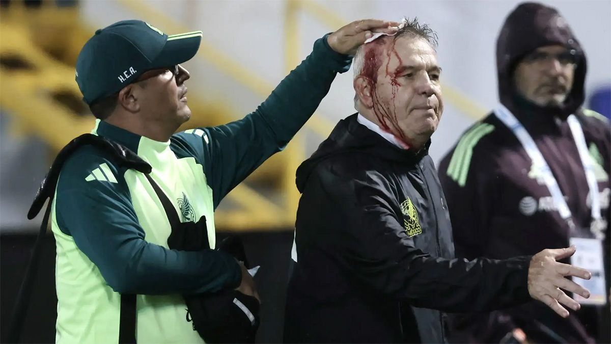 Hondurasfue castigada por la Concacaf con la disputa de un partido sin público tras laagresión que sufrió el entrenador de México, Javier Aguirre.