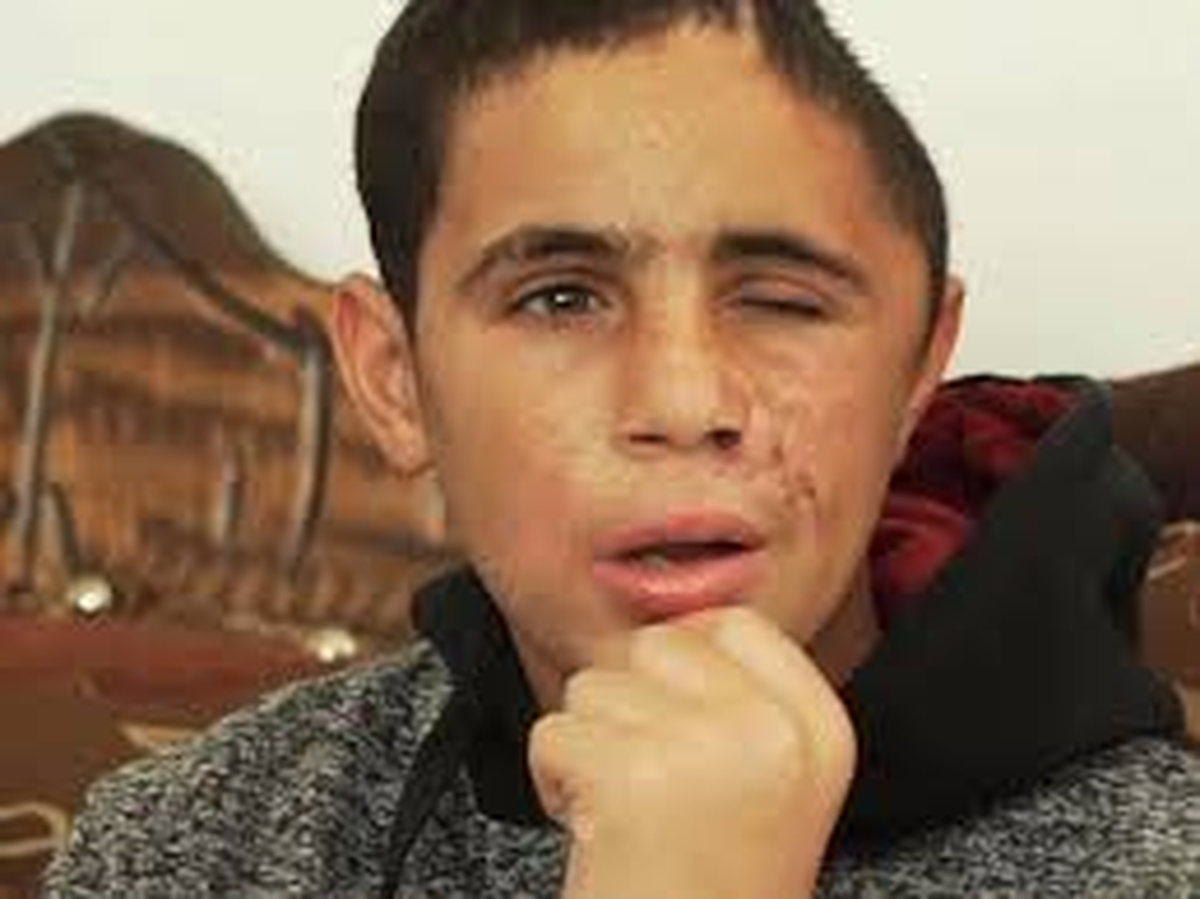 Primo de Ahed Tamimi con herida en el cráneo tras el intento de asesinato por parte de las fuerzas israelíes. Primo de Ahed Tamimi con herida en el cráneo tras el intento de asesinato por parte de las fuerzas israelíes.