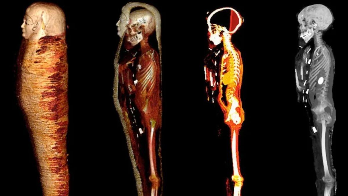 La momia de un adolescente fue enterrada con un corazón de oro hace 2.300 años en Egipto. Se descubrió gracias a un escáner de un tomógrafo computarizado.