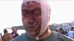 Ostrovsky relató: Estaba aquí con mi familia, era la celebración de Janucá. Había cientos de personas, niños, familias mayores disfrutando del festival, y de repente, todo fue un caos. No sabíamos qué estaba pasando, de dónde venía el fuego. Vi sangre brotando frente a mí, a personas ser alcanzadas y caer al suelo. Mi única preocupación era dónde estaba mi familia. Ostrovsky relató: Estaba aquí con mi familia, era la celebración de Janucá. Había cientos de personas, niños, familias mayores disfrutando del festival, y de repente, todo fue un caos. No sabíamos qué estaba pasando, de dónde venía el fuego. Vi sangre brotando frente a mí, a personas ser alcanzadas y caer al suelo. Mi única preocupación era dónde estaba mi familia.