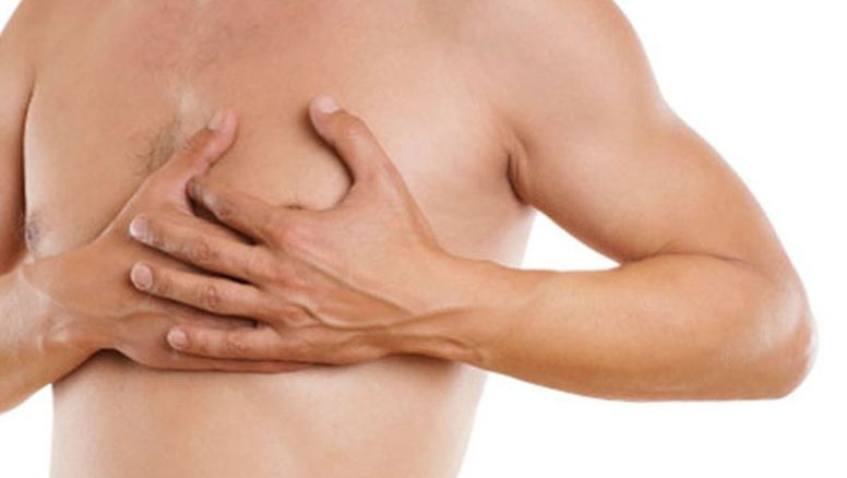 Cáncer de mama masculino: Ojo con estos síntomas ocultos