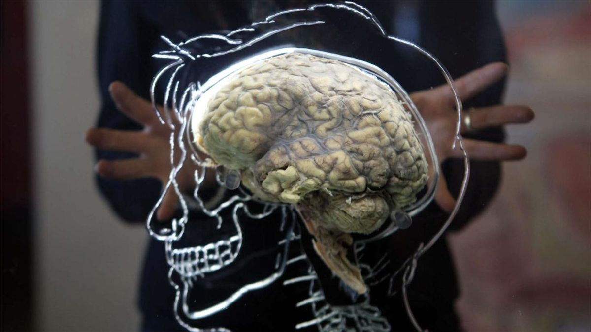 La enfermedad de Alzheimer afecta al 70% de las personas que son diagnosticadas de demencia en el mundo. La enfermedad de Alzheimer afecta al 70% de las personas que son diagnosticadas de demencia en el mundo.