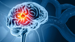 Un equipo científico encontró una nueva terapia para el cáncer de cerebro con resultados que ofrecen nueva esperanza a pacientes que lo padecen. ¡Descubrí cómo! Un equipo científico encontró una nueva terapia para el cáncer de cerebro con resultados que ofrecen nueva esperanza a pacientes que lo padecen. ¡Descubrí cómo!