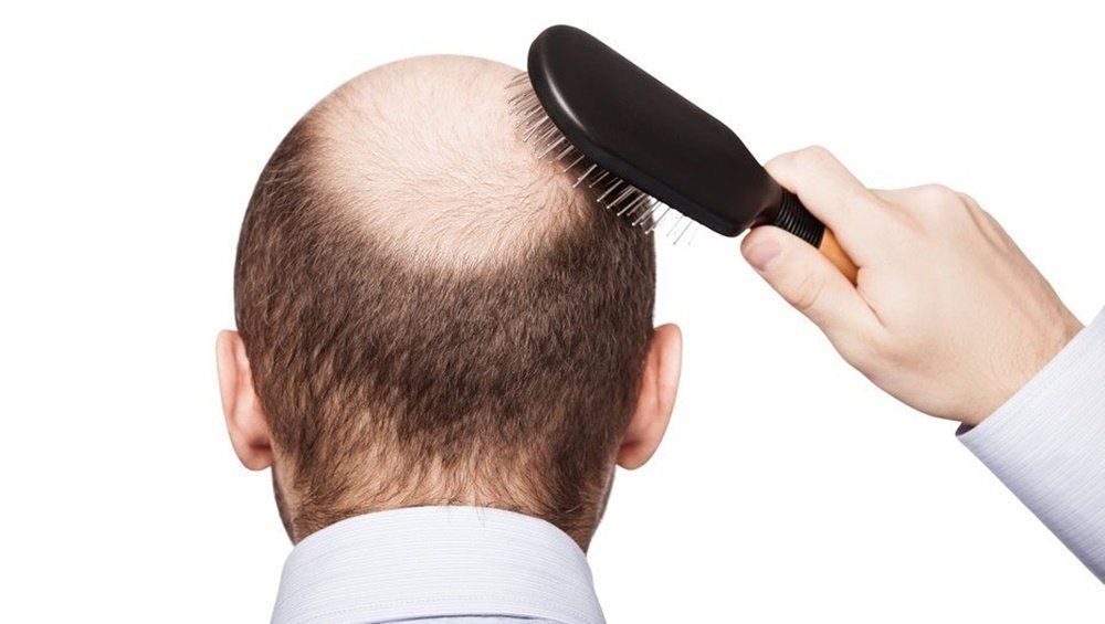 remedios caseros para y caída del cabello