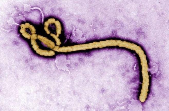 El virus del ébola es muy mortal. El virus del ébola es muy mortal.