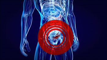 Cáncer de colon: El alimento que todos deben evitar / Imagen de julos en Freepik. Cáncer de colon: El alimento que todos deben evitar / Imagen de julos en Freepik.
