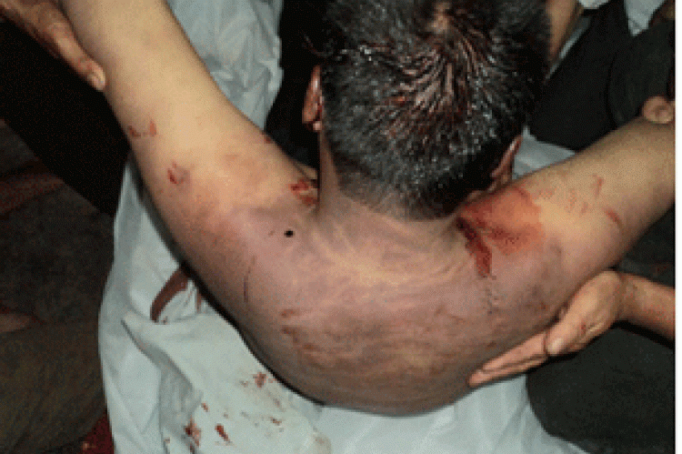 Más de 300 testigos vieron el cuerpo de Ngai con muchos golpes y moratones, cortes profundos y el cráneo roto, estigmatizando que la autopsia se ha llevado a cabo sin el conocimiento de la familia.