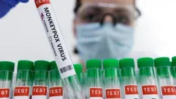 Viruela del mono: Testeos en Rosario para diagnosticar la enfermedad