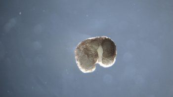 xenobots: los primeros robots vivos que pueden reproducirse xenobots: los primeros robots vivos que pueden reproducirse