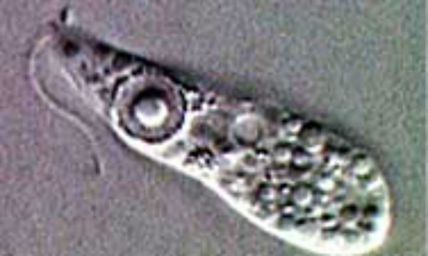 Ameba comecerebros: Naegleria fowleri