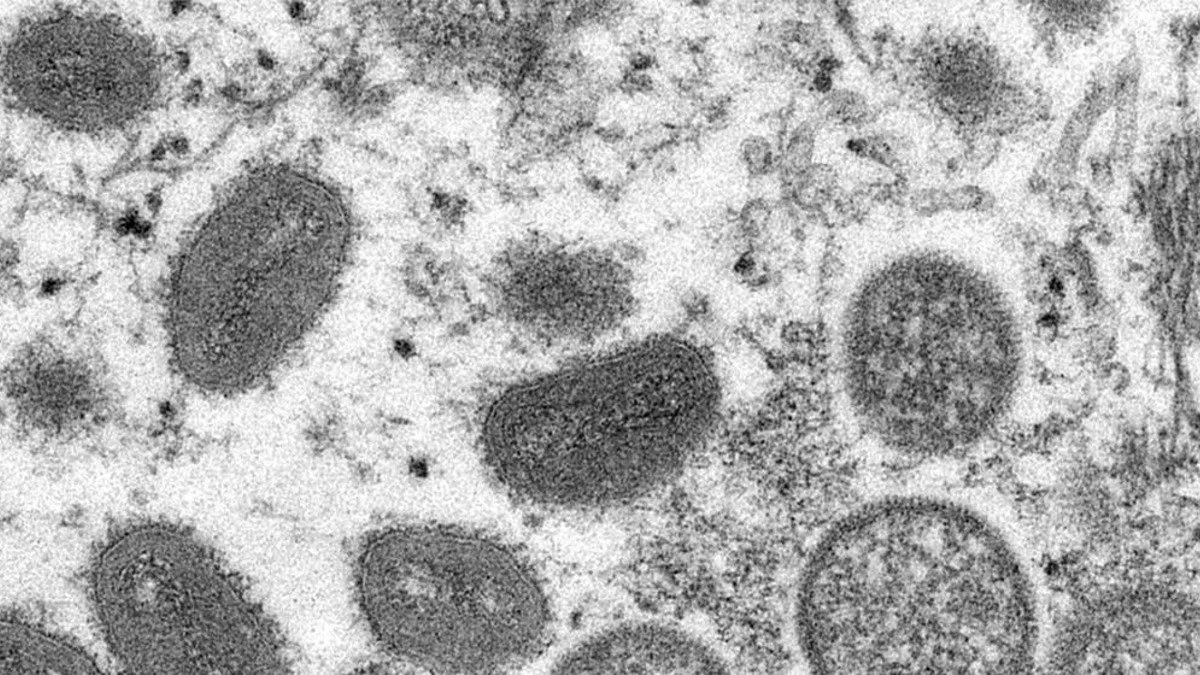 La OMS cambió la denominación de la viruela del mono en noviembre del 2022 por "mpox" como sinónimo de “monkeypox” (viruela símica en español).