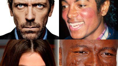 Lupus, la obsesión de Dr. House ataca Hollywood