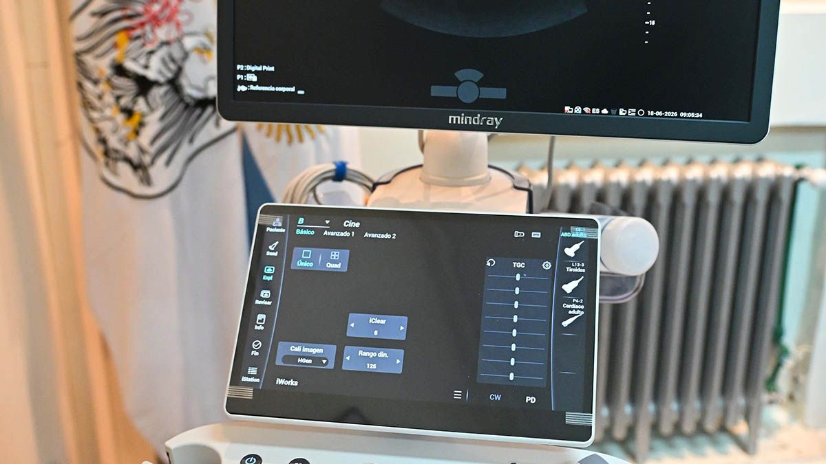 El Banco Ciudad y su Fundación entregaron nuevo equipamiento médico al Hospital Zubizarreta que beneficiará a más de 12.000 pacientes. El Banco Ciudad y su Fundación entregaron nuevo equipamiento médico al Hospital Zubizarreta que beneficiará a más de 12.000 pacientes.