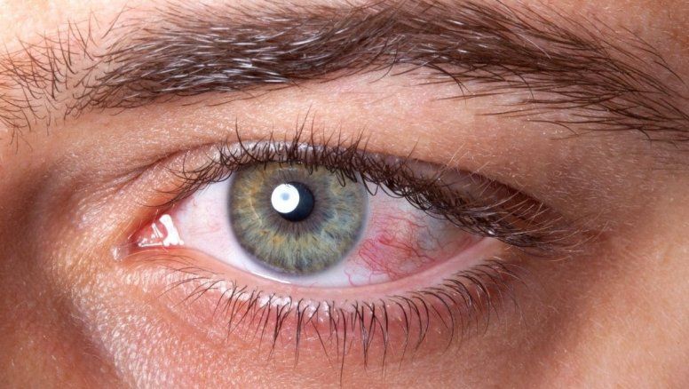 Síntomas de que la diabetes está dañando tu retina
