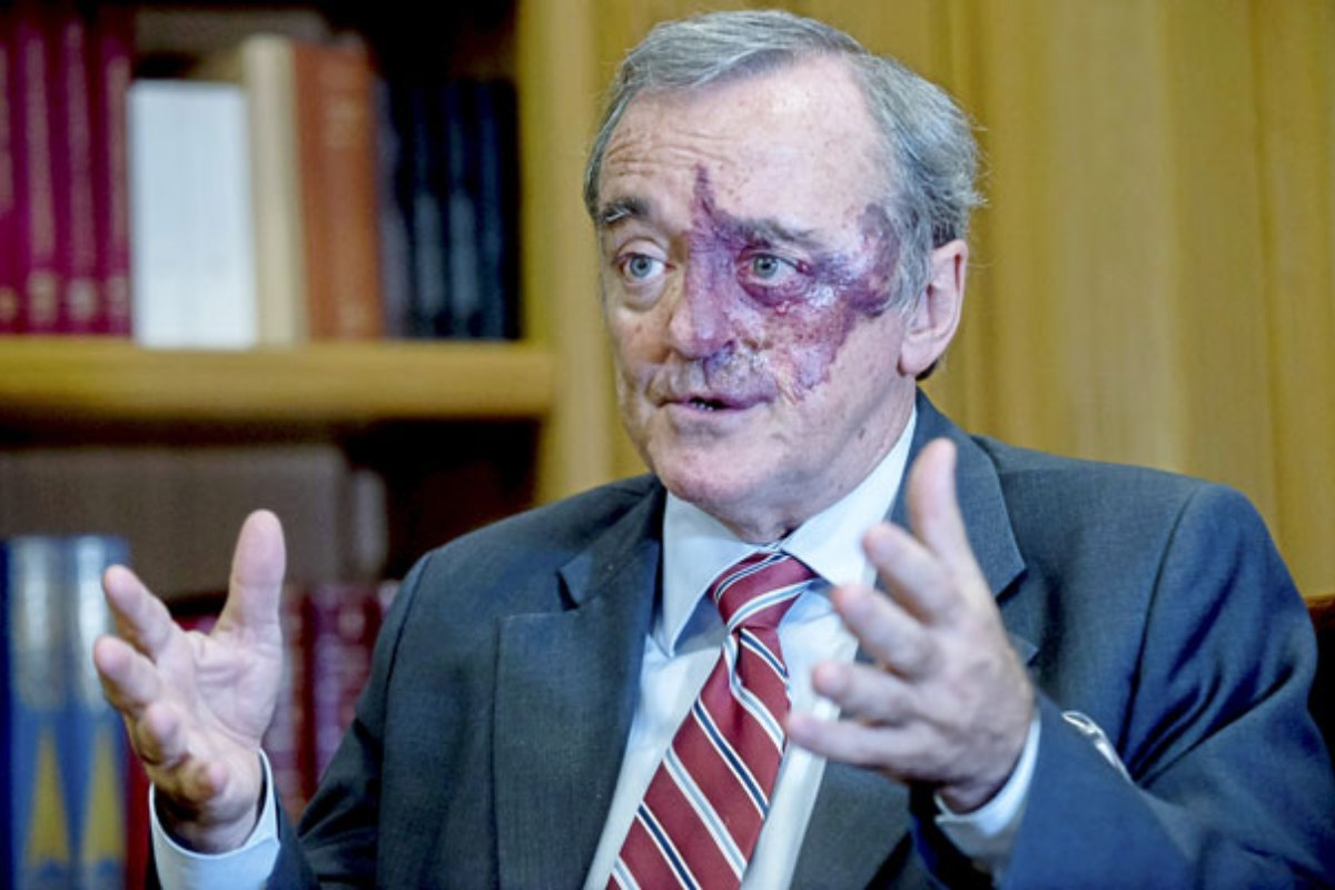 Mariano Barbacid.  Cáncer de páncreas