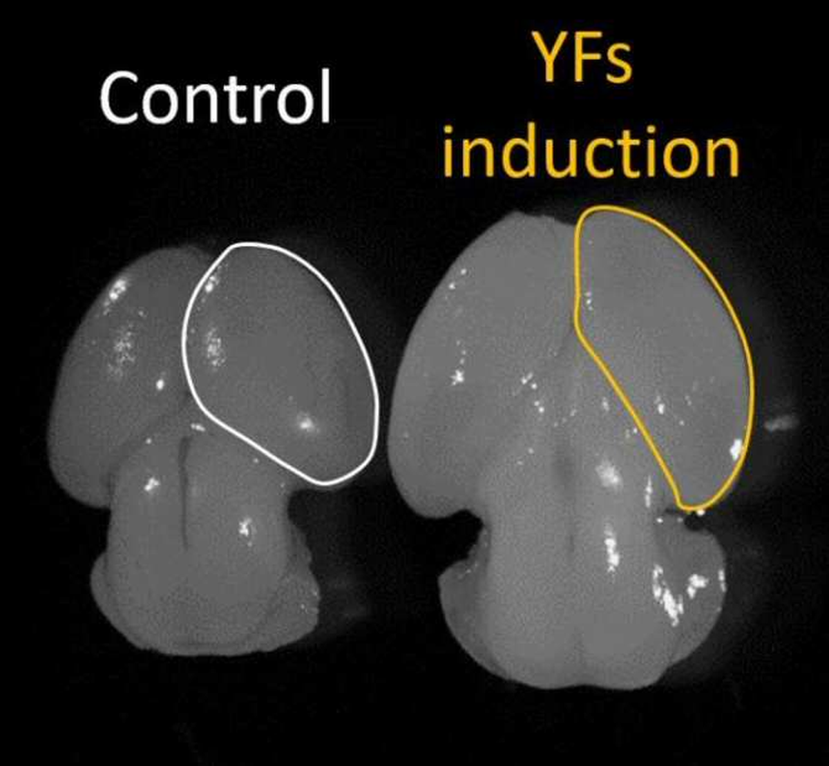 Estos hallazgos abren nuevas posibilidades para tratamientos clínicos y terapias futuras en el campo de la neurociencia. Estos hallazgos abren nuevas posibilidades para tratamientos clínicos y terapias futuras en el campo de la neurociencia.
