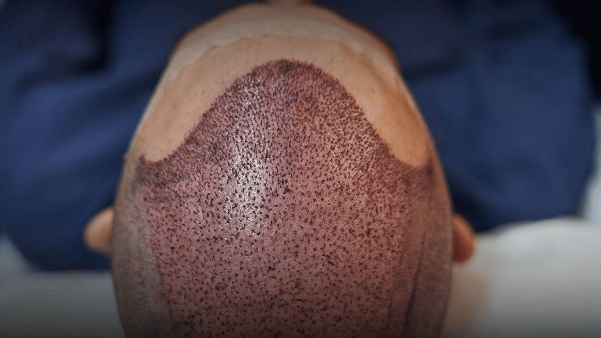 El modelo de Turquía que transformó la industria del cabello.&nbsp;