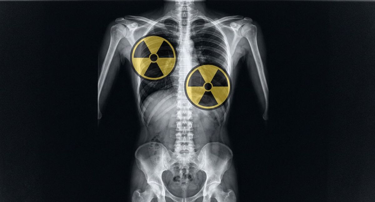 Pilotos y auxiliares de vuelo quedaron entre las ocupaciones con mayor proporción de muertes por cáncer asociado a radiación en el análisis.