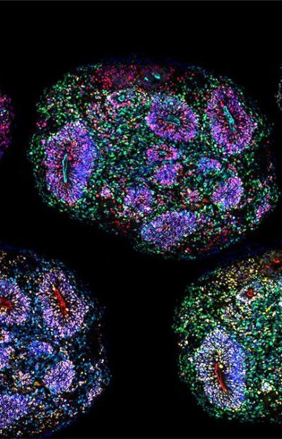 Cómo se cultivan minicerebros humanos en laboratorio