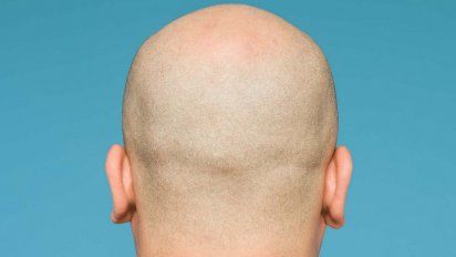 Cómo frenar la alopecia y fortalecer el cabello, según dermatóloga