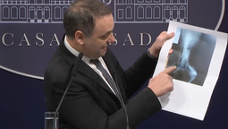 Manuel Adorni dijo que el Gobierno descubrió el esquema de corrupción que había en la agencia de discapacidad.
