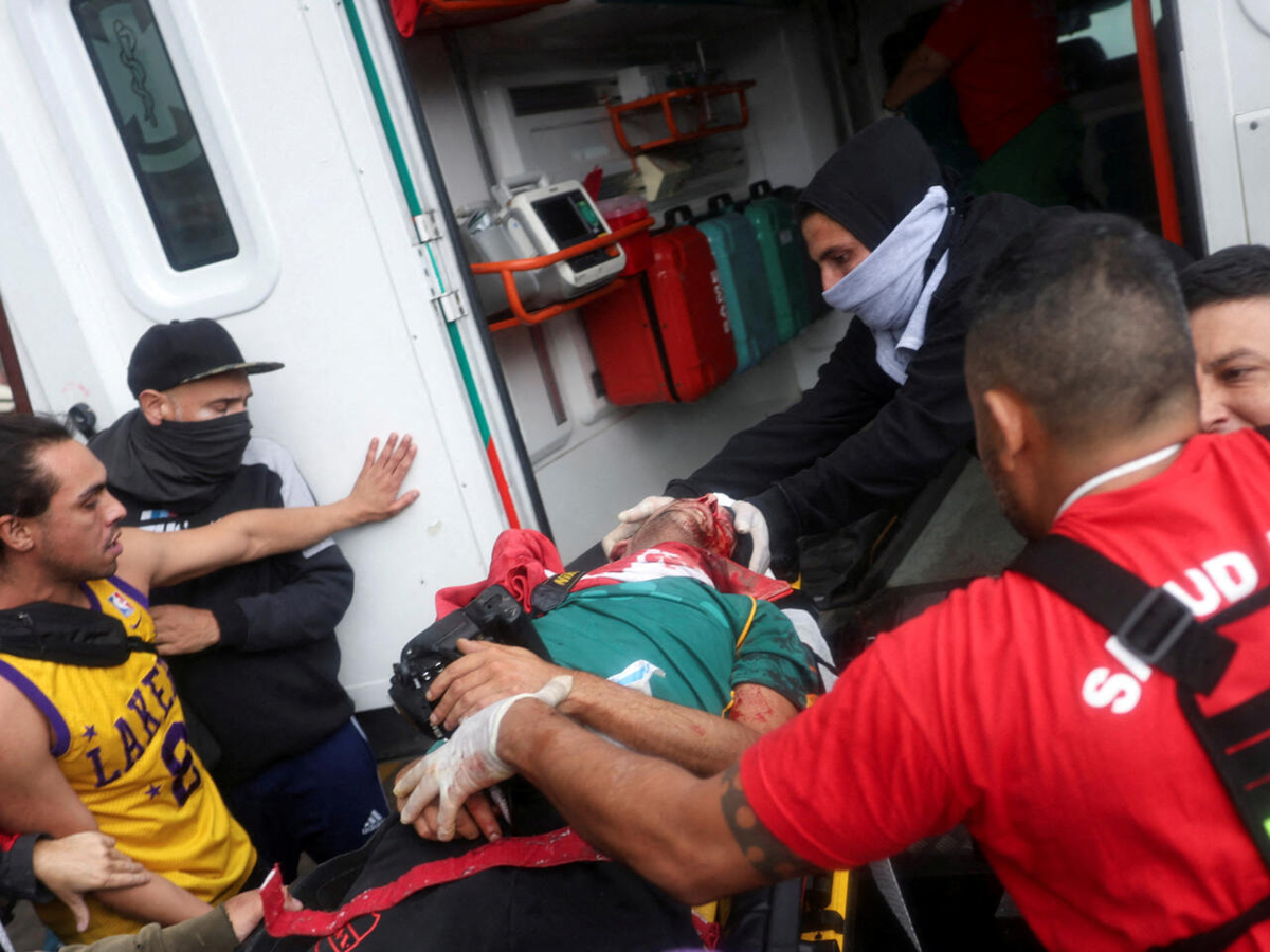 El fotógrafo Pablo Grillo sufrió heridas al ser impactado en la cabeza con un proyectil de gas mientras cubría una marcha de jubilados en la Plaza del Congreso. El fotógrafo Pablo Grillo sufrió heridas al ser impactado en la cabeza con un proyectil de gas mientras cubría una marcha de jubilados en la Plaza del Congreso.