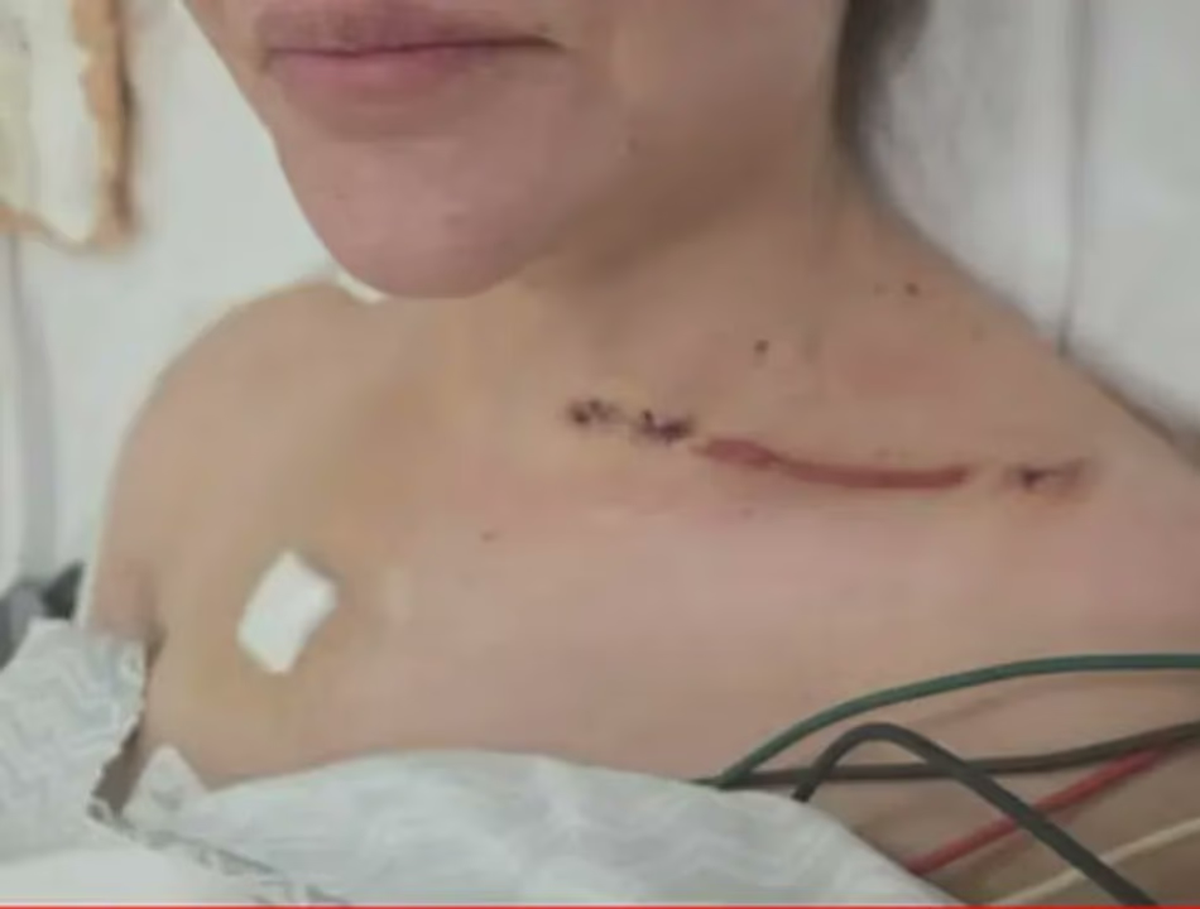 Fotos de una de las heridas que expuso Nadia Beller tomadas donde está internada. Fotos de una de las heridas que expuso Nadia Beller tomadas donde está internada.