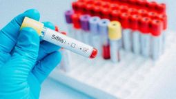 Síntomas de la sífilis y cómo avanza en Argentina. Síntomas de la sífilis y cómo avanza en Argentina.