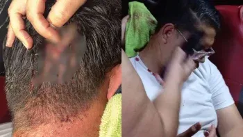 Ataque con explosivos a opositores en Honduras y aún sin resultados electorales