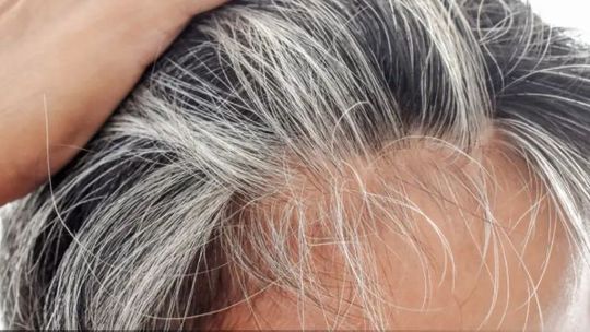 Las canas no son sinónimo de envejecimiento, sino sordas luchas que libra el cuerpo
