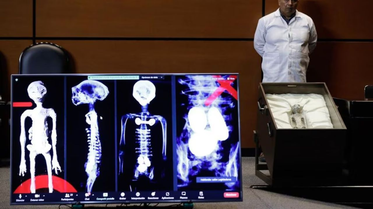 Acá una de las muestras de rayos X. Acá una de las muestras de rayos X. 